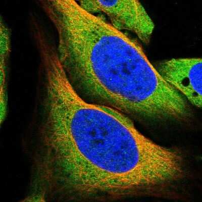 Immunocytochemistry/ Immunofluorescence: Mucolipin 1 Antibody [NBP1-92152]