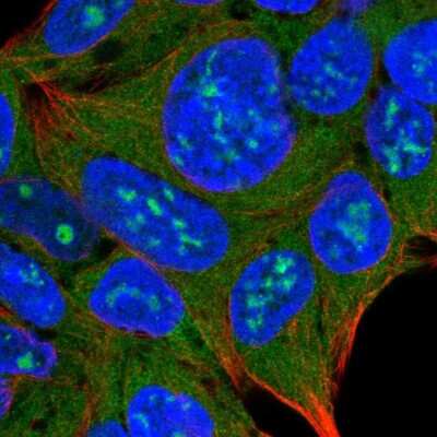 Immunocytochemistry/ Immunofluorescence: Mucolipin 3 Antibody [NBP1-83791]