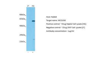 Western Blot: Mucolipin 3 Antibody [NBP2-85338]