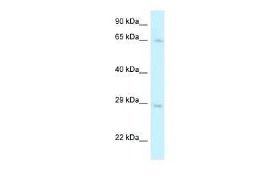 Western Blot: Mus81 Antibody [NBP2-87860]