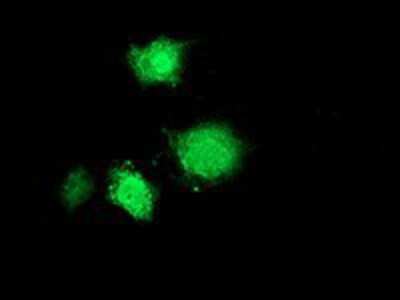 Immunocytochemistry/ Immunofluorescence: Musashi-1 Antibody (OTI1G8) [NBP2-03434]