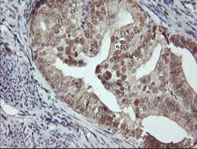 Immunohistochemistry-Paraffin: Musashi-1 Antibody (OTI1G8) [NBP2-03434]