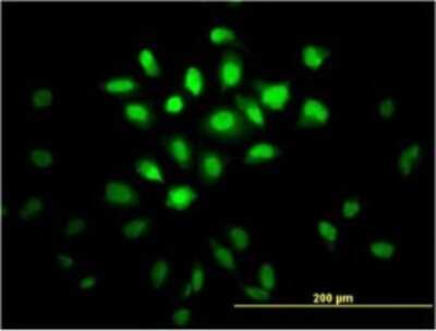 Immunocytochemistry/ Immunofluorescence: Musashi-1 Antibody (3F2) [H00004440-M04]