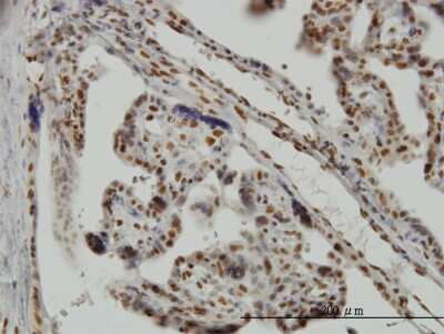 Immunohistochemistry-Paraffin: Musashi-1 Antibody (3F2) [H00004440-M04]