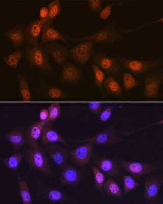 Immunocytochemistry/ Immunofluorescence: Musashi-1 Antibody (9S7Y1) [NBP3-16754]