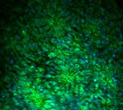 Immunocytochemistry/ Immunofluorescence: Musashi-1 Antibody - BSA Free [NB100-1759]