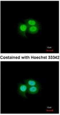 Immunocytochemistry/ Immunofluorescence: Musashi-1 Antibody [NBP1-32812]