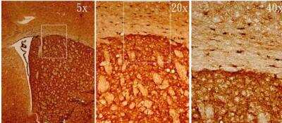 Immunohistochemistry-Frozen: Musashi-1 Antibody [NBP1-32812]