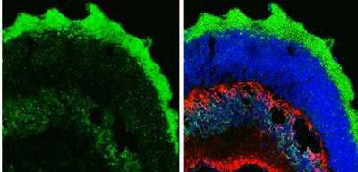 Immunohistochemistry-Frozen: Musashi-1 Antibody [NBP1-32812]