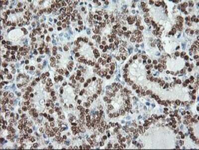 Immunohistochemistry: Musashi-1 Antibody (OTI1G8) - Azide and BSA Free [NBP2-72828]