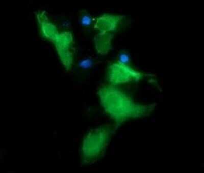 Immunocytochemistry/ Immunofluorescence: Musashi-2 Antibody (OTI2F10) - Azide and BSA Free [NBP2-72836]