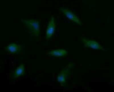 Immunocytochemistry/ Immunofluorescence: Musashi-2 Antibody (OTI2F10) - Azide and BSA Free [NBP2-72836]