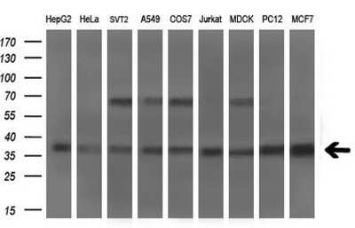 Western Blot: Musashi-2 Antibody (OTI2F10)Azide and BSA Free [NBP2-72836]