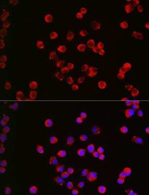 Immunocytochemistry/ Immunofluorescence: Muscarinic Acetylcholine Receptor M1/CHRM1 Antibody - Azide and BSA Free [NBP2-94511]