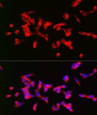 Immunocytochemistry/ Immunofluorescence: Muscarinic Acetylcholine Receptor M1/CHRM1 Antibody - Azide and BSA Free [NBP2-94511]