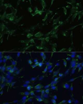 Immunocytochemistry/ Immunofluorescence: Muscarinic Acetylcholine Receptor M1/CHRM1 Antibody - Azide and BSA Free [NBP2-94811]