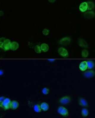 Immunocytochemistry/ Immunofluorescence: Muscarinic Acetylcholine Receptor M1/CHRM1 Antibody - Azide and BSA Free [NBP2-94811]