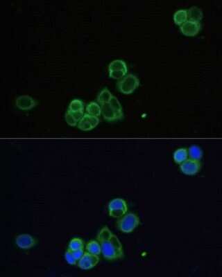 Immunocytochemistry/ Immunofluorescence: Muscarinic Acetylcholine Receptor M1/CHRM1 Antibody - Azide and BSA Free [NBP2-94811]