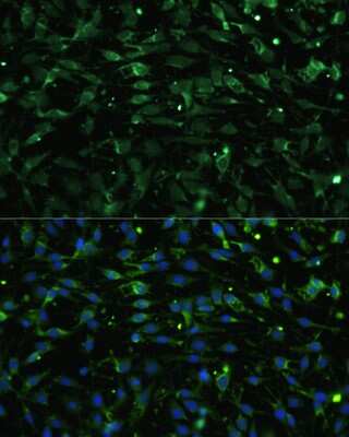 Immunocytochemistry/ Immunofluorescence: Muscarinic Acetylcholine Receptor M1/CHRM1 Antibody - Azide and BSA Free [NBP2-94811]