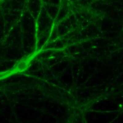 Immunohistochemistry: Muscarinic Acetylcholine Receptor M1/CHRM1 Antibody [NBP1-87466]