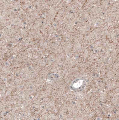 Immunohistochemistry-Paraffin: Muscarinic Acetylcholine Receptor M3/CHRM3 Antibody [NBP1-87547]