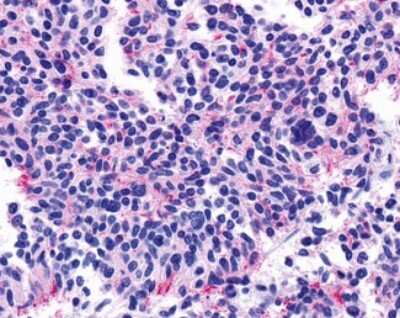 Immunohistochemistry-Paraffin: Muscarinic Acetylcholine Receptor M5/CHRM5 Antibody - BSA Free [NLS1338]