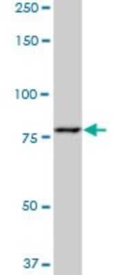 Western Blot: Muscle Phosphofructokinase/PFKM/PFK-1 Antibody (1D1) [H00005213-M04]