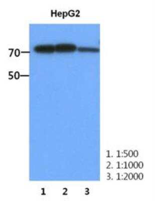 Western Blot: Muscle Phosphofructokinase/PFKM/PFK-1 Antibody (2F11)BSA Free [NBP2-22615]