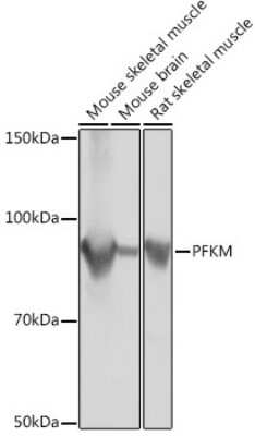 Western Blot: Muscle Phosphofructokinase/PFKM/PFK-1 Antibody (4Z7X1) [NBP3-16242]
