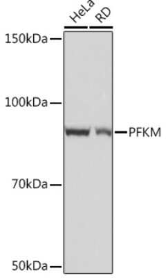Western Blot: Muscle Phosphofructokinase/PFKM/PFK-1 Antibody (4Z7X1) [NBP3-16242]