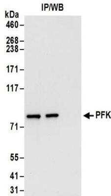 Immunoprecipitation: Muscle Phosphofructokinase/PFKM/PFK-1 Antibody [NBP2-32169]