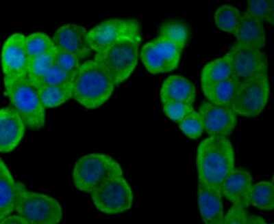 Immunocytochemistry/ Immunofluorescence: Muscle Phosphofructokinase/PFKM/PFK-1 Antibody (JU53-31) [NBP2-75578]