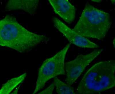 Immunocytochemistry/ Immunofluorescence: Muscle Phosphofructokinase/PFKM/PFK-1 Antibody (JU53-31) [NBP2-75578]