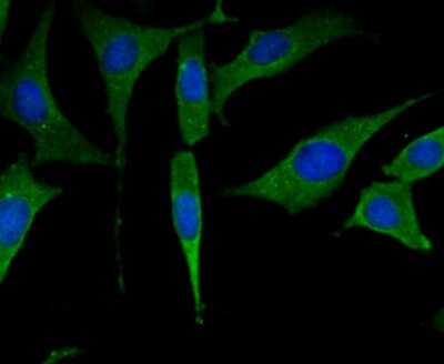 Immunocytochemistry/ Immunofluorescence: Muscle Phosphofructokinase/PFKM/PFK-1 Antibody (JU53-31) [NBP2-75578]