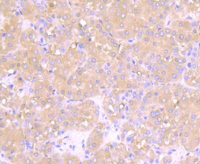 Immunohistochemistry-Paraffin: Muscle Phosphofructokinase/PFKM/PFK-1 Antibody (JU53-31) [NBP2-75578]