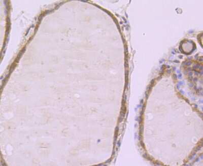 Immunohistochemistry-Paraffin: Muscle Phosphofructokinase/PFKM/PFK-1 Antibody (JU53-31) [NBP2-75578]