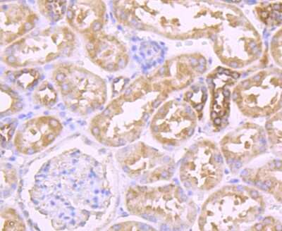 Immunohistochemistry-Paraffin: Muscle Phosphofructokinase/PFKM/PFK-1 Antibody (JU53-31) [NBP2-75578]