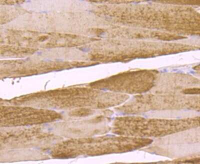 Immunohistochemistry-Paraffin: Muscle Phosphofructokinase/PFKM/PFK-1 Antibody (JU53-31) [NBP2-75578]