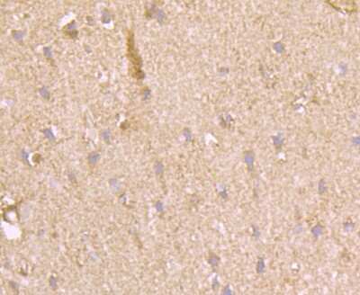 Immunohistochemistry-Paraffin: Muscle Phosphofructokinase/PFKM/PFK-1 Antibody (JU53-31) [NBP2-75578]