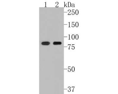 Western Blot: Muscle Phosphofructokinase/PFKM/PFK-1 Antibody (JU53-31) [NBP2-75578]