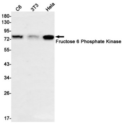 Western Blot: Muscle Phosphofructokinase/PFKM/PFK-1 Antibody (S08-6B4) [NBP3-20013]