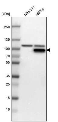 Western Blot: Muscle Phosphofructokinase/PFKM/PFK-1 Antibody [NBP1-87293]
