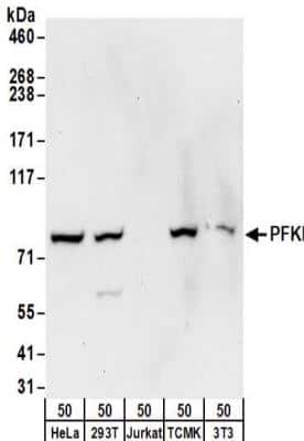 Western Blot: Muscle Phosphofructokinase/PFKM/PFK-1 Antibody [NBP2-32169]