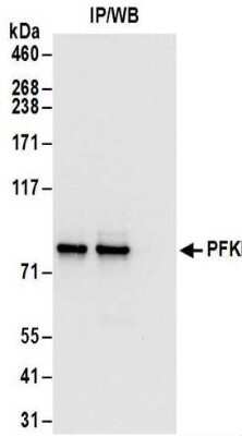 Western Blot: Muscle Phosphofructokinase/PFKM/PFK-1 Antibody [NBP2-32170]