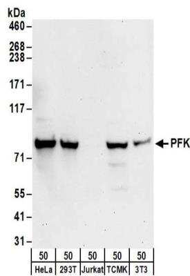 Western Blot: Muscle Phosphofructokinase/PFKM/PFK-1 Antibody [NBP2-32170]