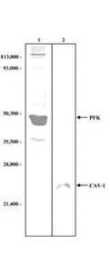 Western Blot: Muscle Phosphofructokinase/PFKM/PFK-1 Antibody [NBP2-44228]