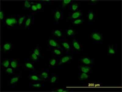 Immunocytochemistry/ Immunofluorescence: Muscleblind-like 1 Antibody (3E7) [H00004154-M02]
