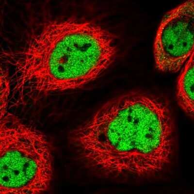 Immunocytochemistry/ Immunofluorescence: Muscleblind-like 1 Antibody [NBP2-55165]