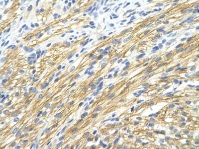 Immunohistochemistry: Muscleblind-like 1 Antibody [NBP1-80488]
