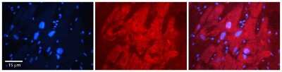 Immunohistochemistry: Muscleblind-like 1 Antibody [NBP1-80489]